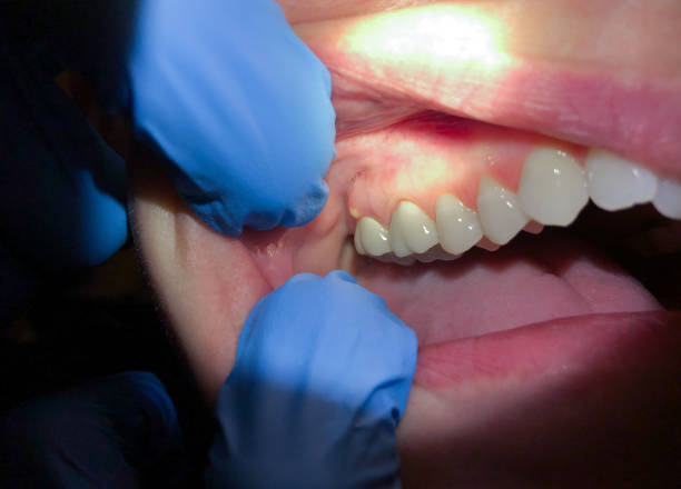 Best Root Canal Emergency Dentist  in Marrero, LA