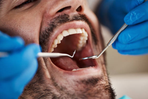 Best Tooth Infection Emergency Dentist  in Marrero, LA